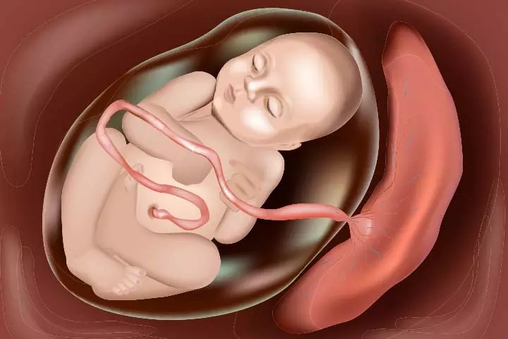 Is Anterior Placenta A Risk Element For Birth Complications